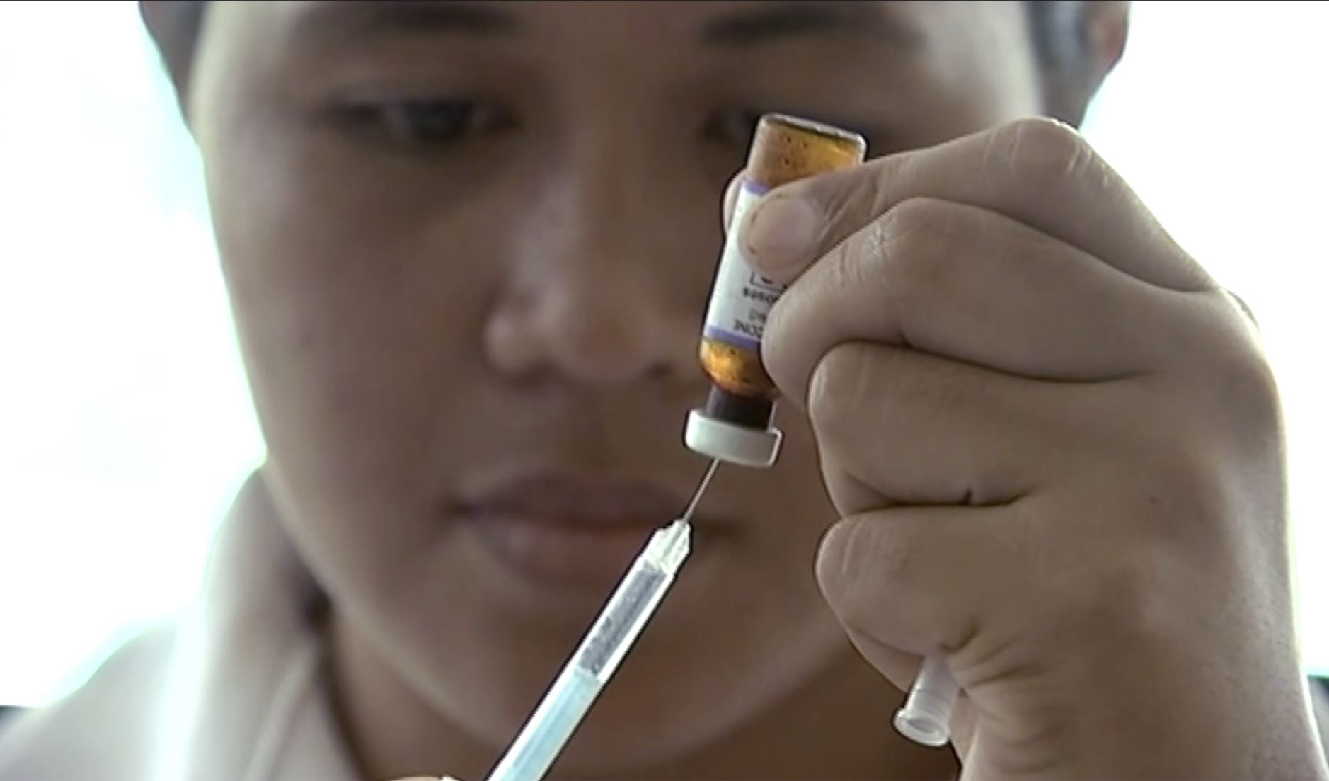 Measles